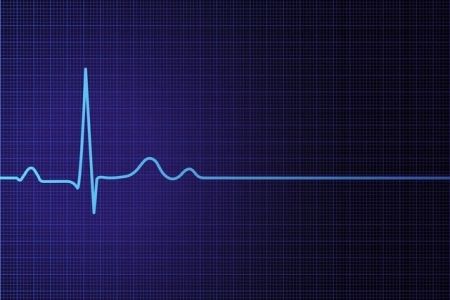 Қарақалпақстанда қайсы кеселликлерден қайтыс болыў жағдайлары көбирек бақланған?